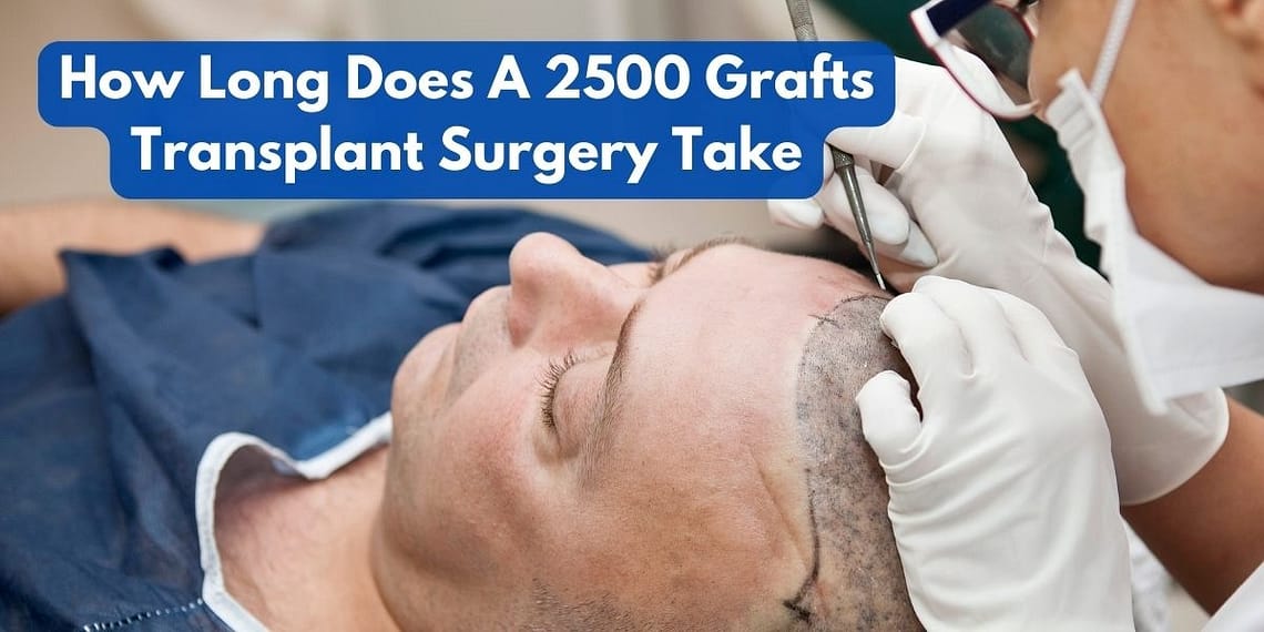 How Long Does A 2500 Grafts Transplant Surgery Take