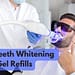 How To Choose The Right Teeth Whitening Gel Refills?