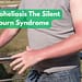 Dermatoheliosis The Silent Sunburn Syndrome