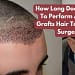 How Long Does It Take To Perform A 2000 Grafts Hair Transplant Surgery